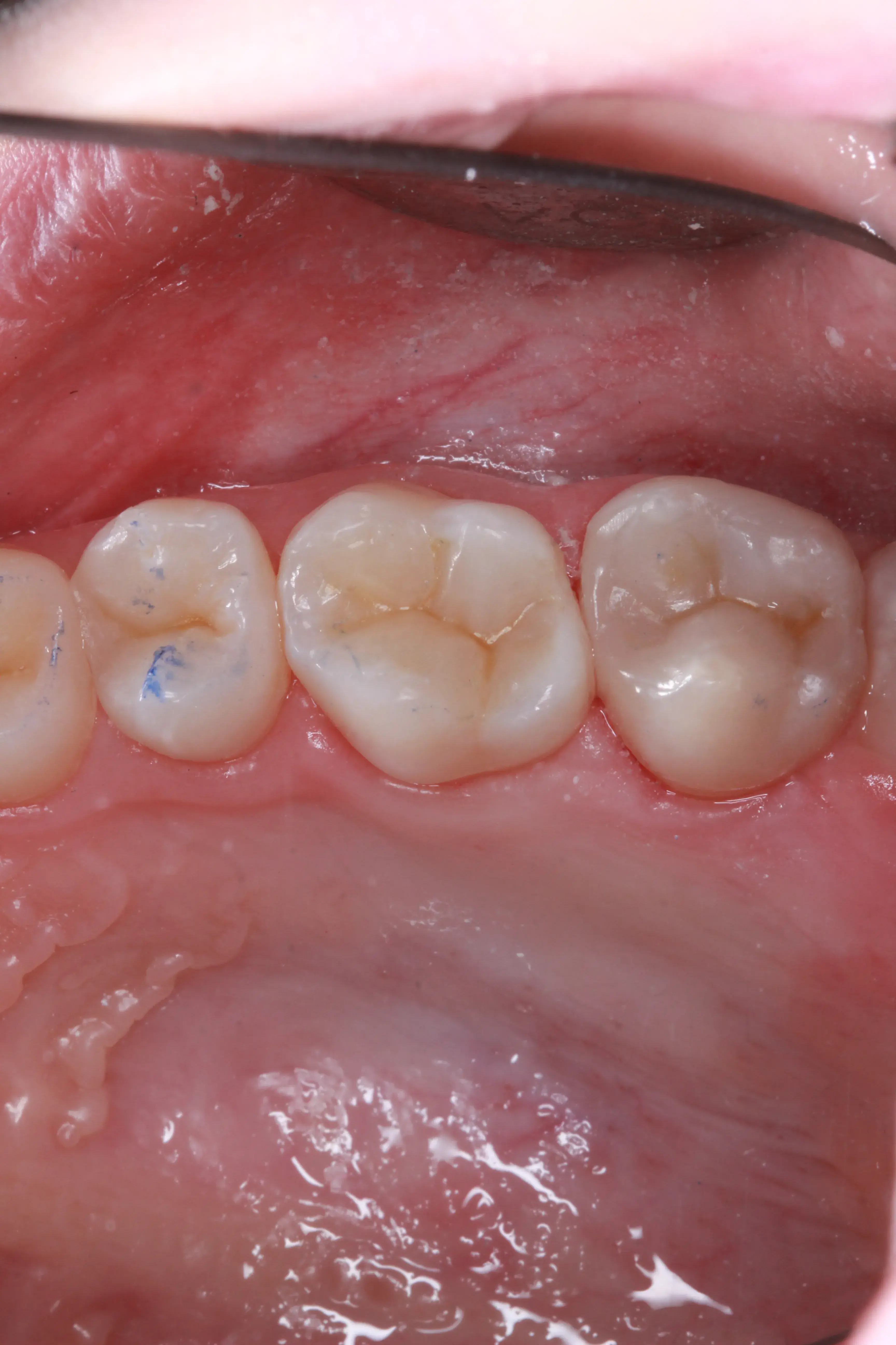 After Image