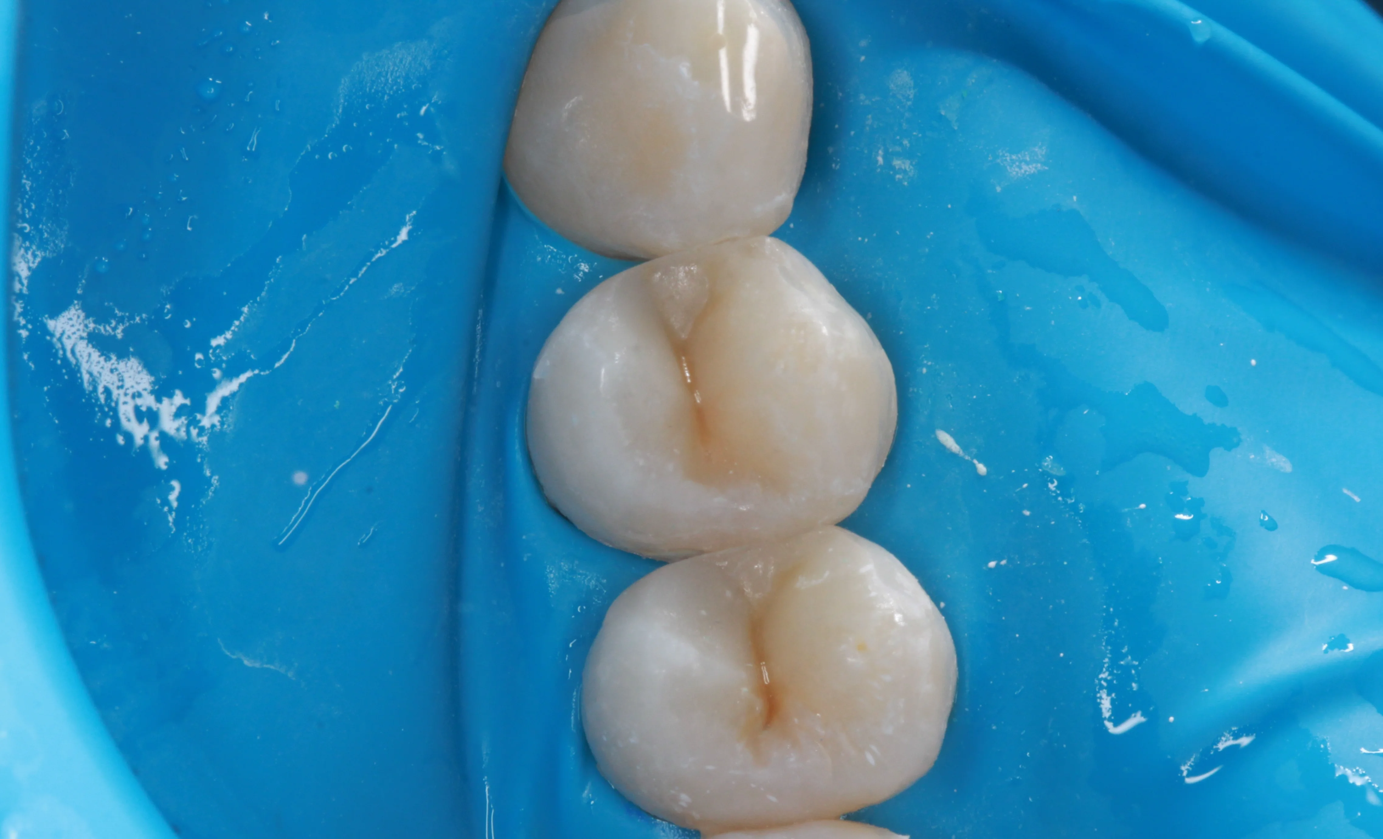 After Image