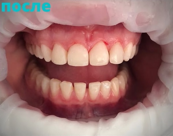 After Image