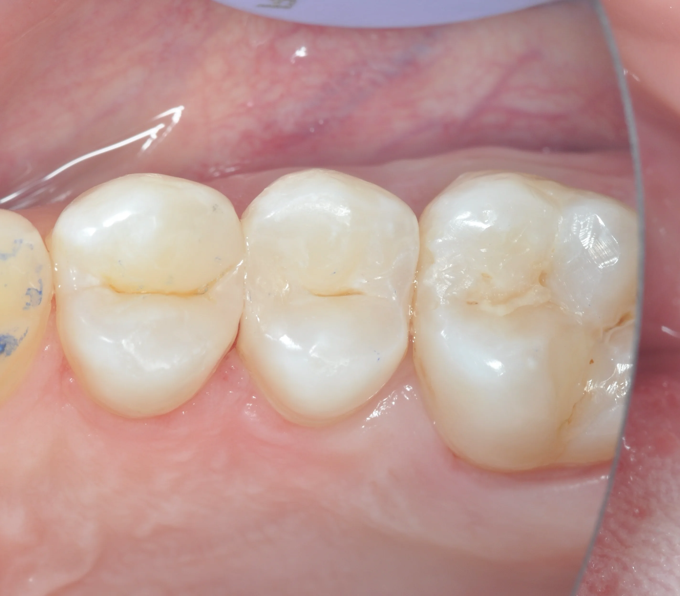 After Image