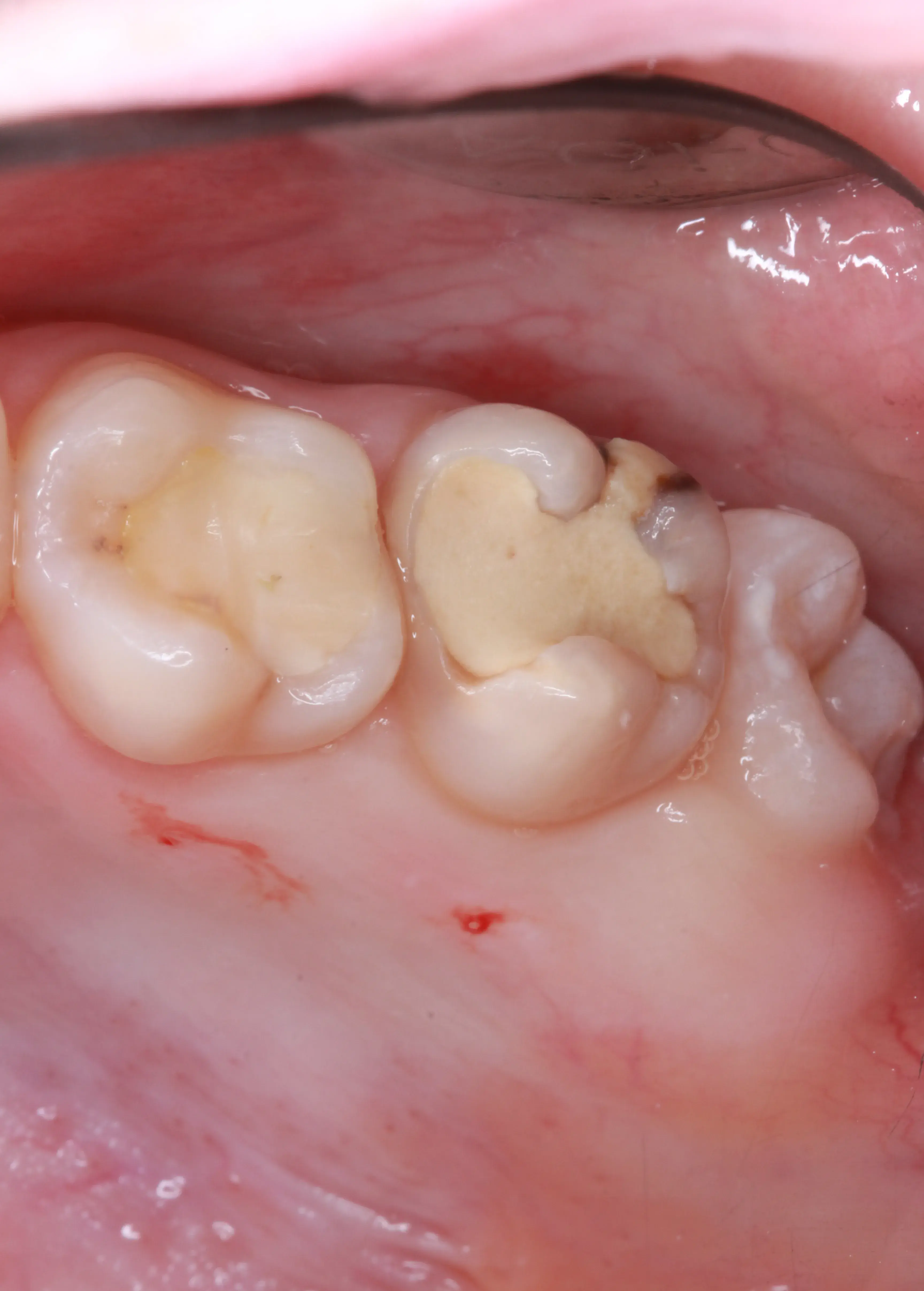 Before Image