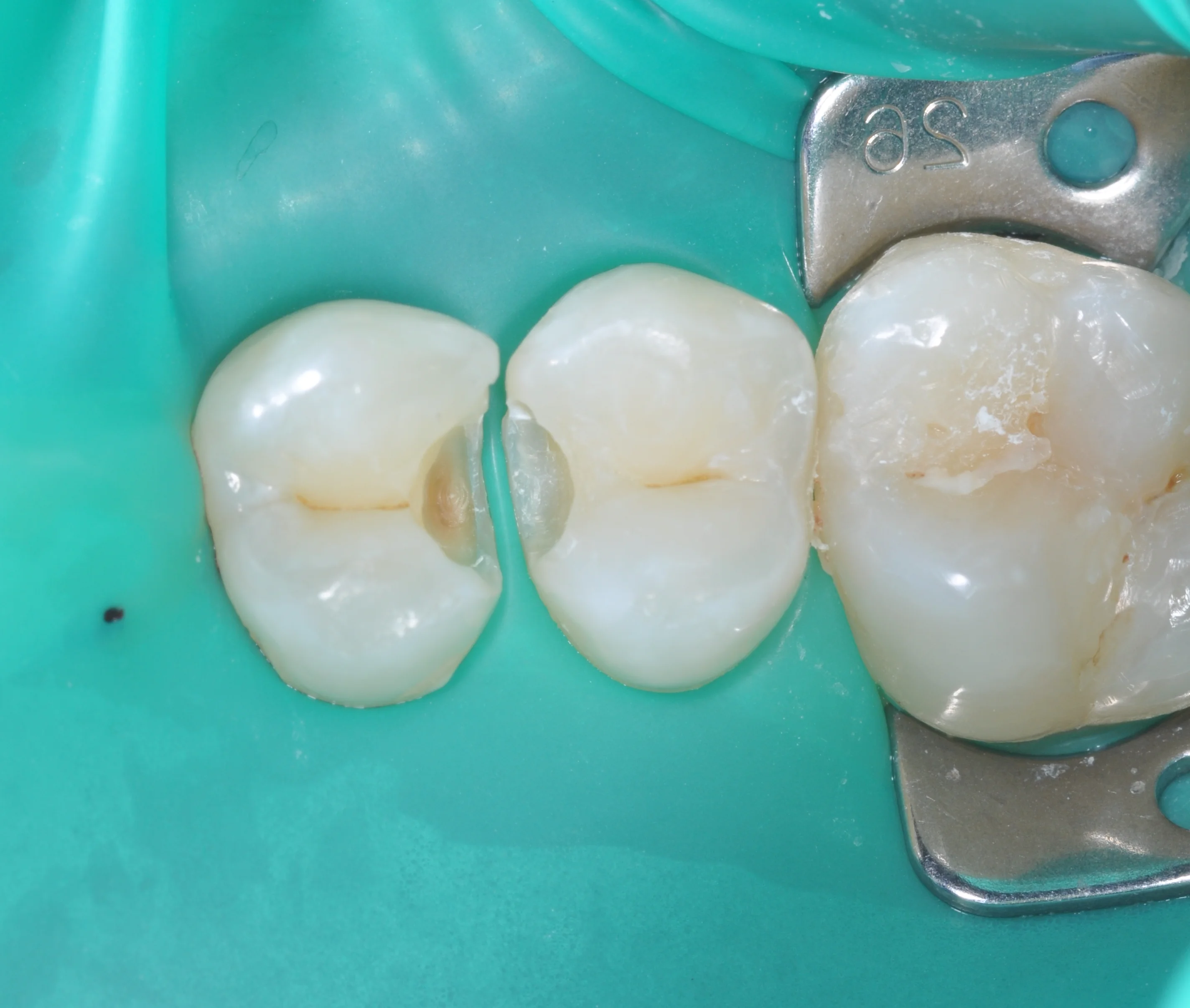 Before Image